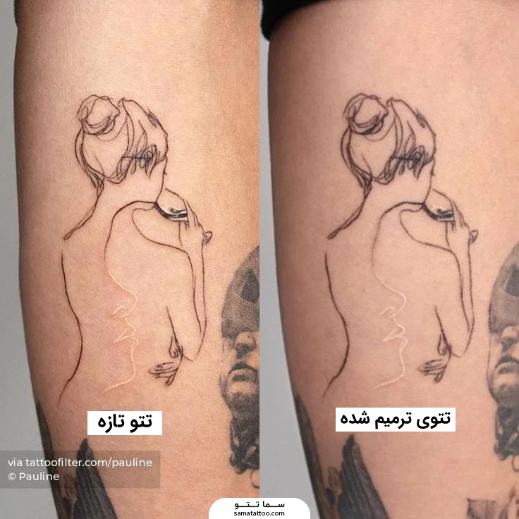 تتو تازه و تتوی ترمیم شده