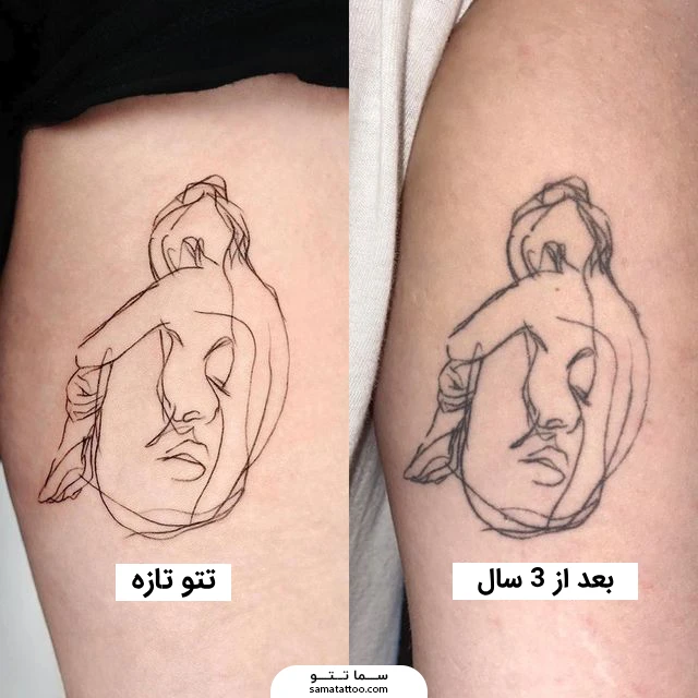 تتوی تازه و تتوی بهبود یافته