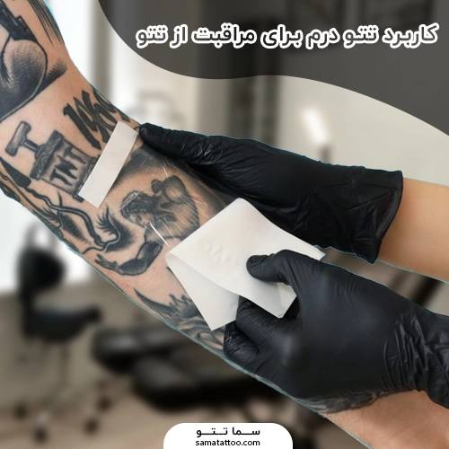 مراقبت بعد تتو