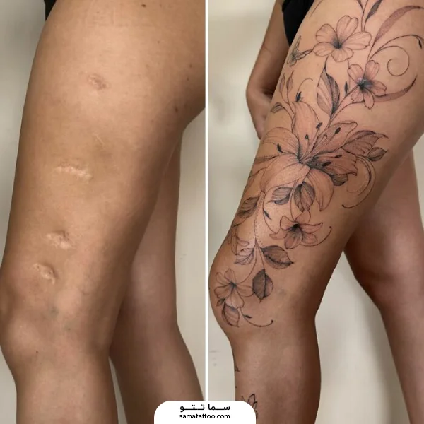 تاتو گل روی زخم پا