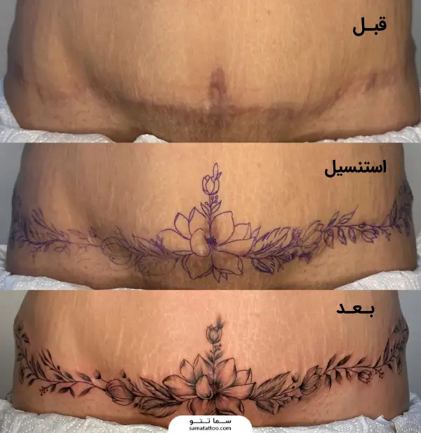 مراحل کاور خط ابدو