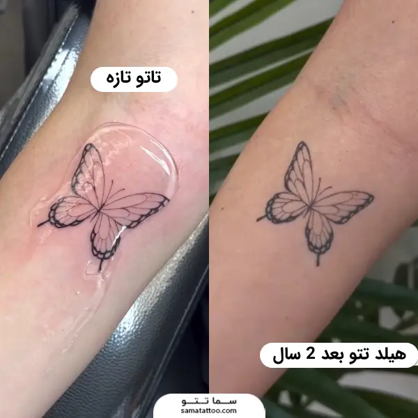 هیلد تاتو پروانه بعد 2 سال