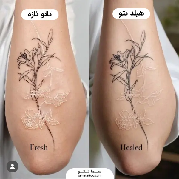 تاتو تازه و هیلد تتو