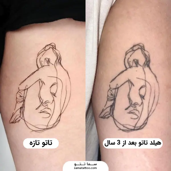 تاتو تازه و هیلد تتو بعد از 3 سال