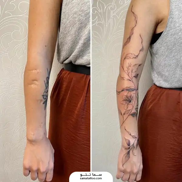 تاتو گل روی زخم