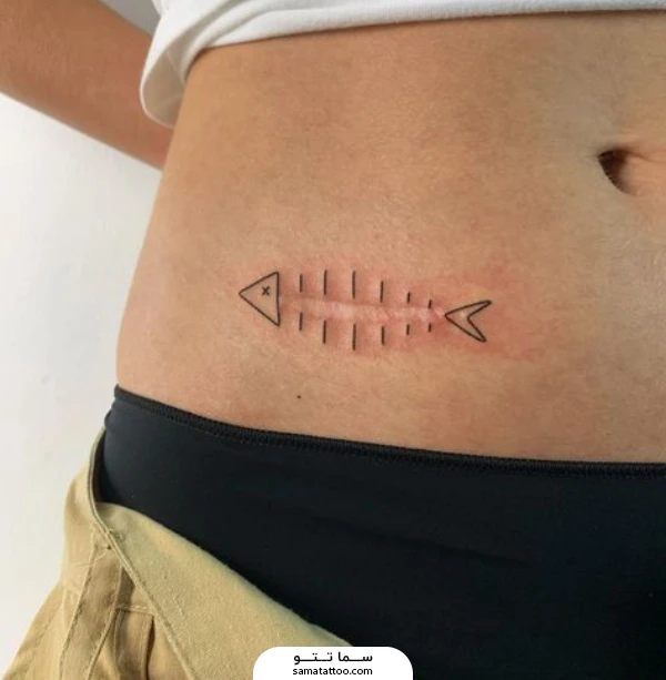 کاور زخم روی شکم با طرح بامزه ماهی