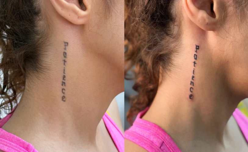 ترمیم تاتو قدیمی